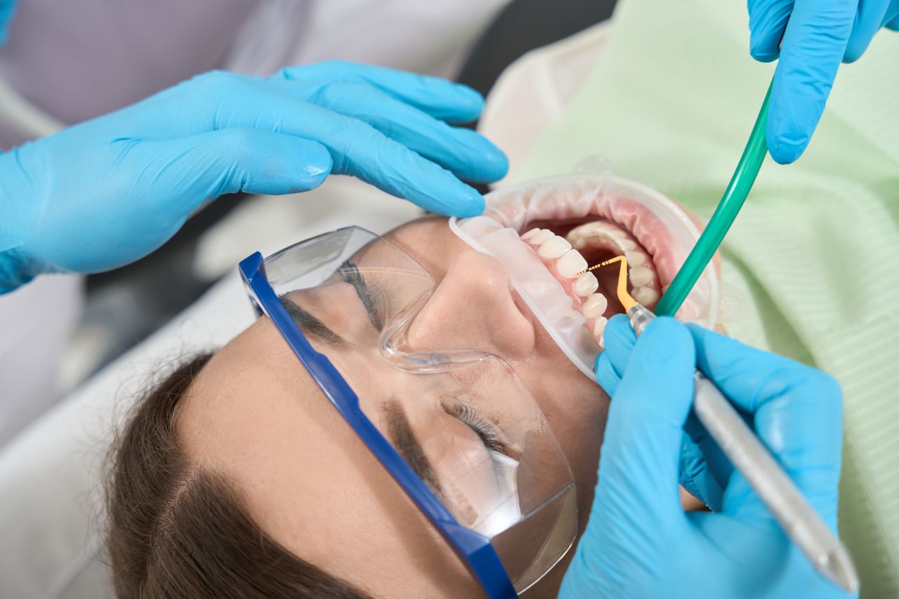 igiene dentale professionale